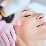 Say Goodbye to Fine Lines with Laser Skin Resurfacing